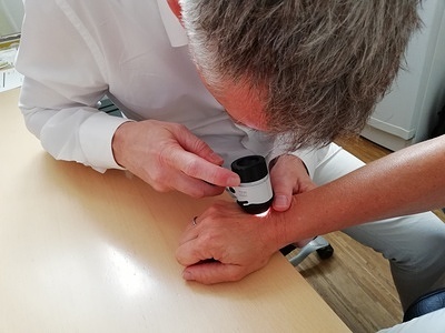 A screening test for skin cancer, being carried out on a person's wrist with some kind of magnifier or dermatoscope.